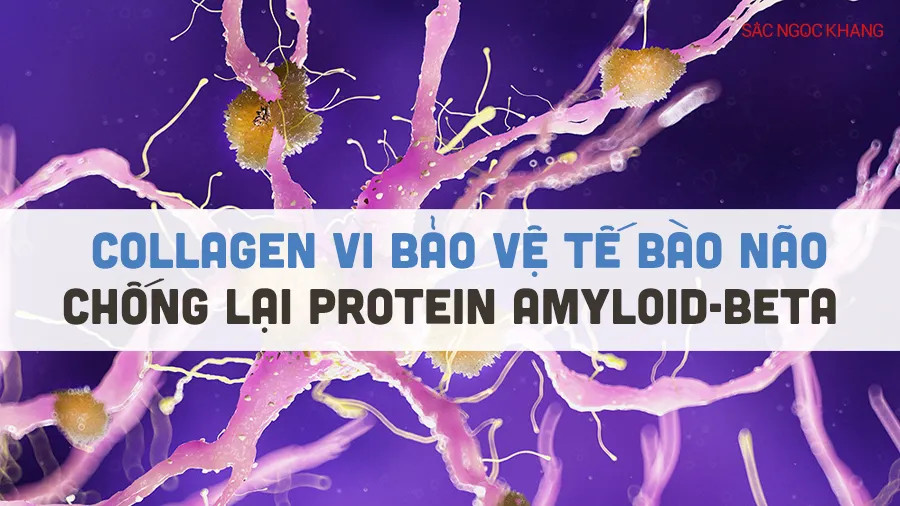 Collagen VI bảo vệ tế bào não chống lại protein amyloid-beta