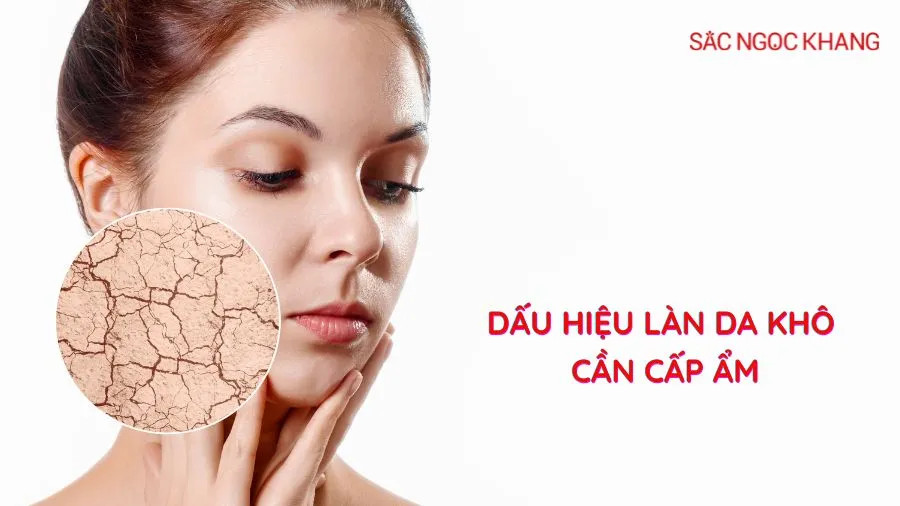 Dấu hiệu làn da khô cần cấp ẩm – bạn đã biết chưa?