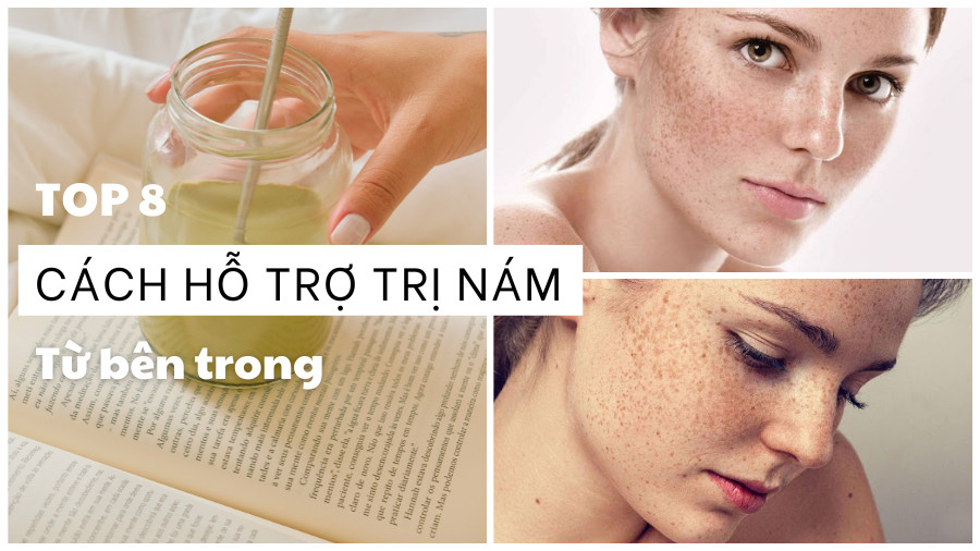 8+ cách hỗ trợ trị nám từ bên trong an toàn, hiệu quả chị em cần biết