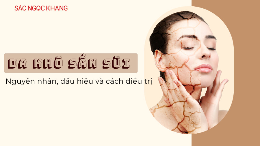 Da khô sần sùi: Nguyên nhân, dấu hiệu và cách điều trị