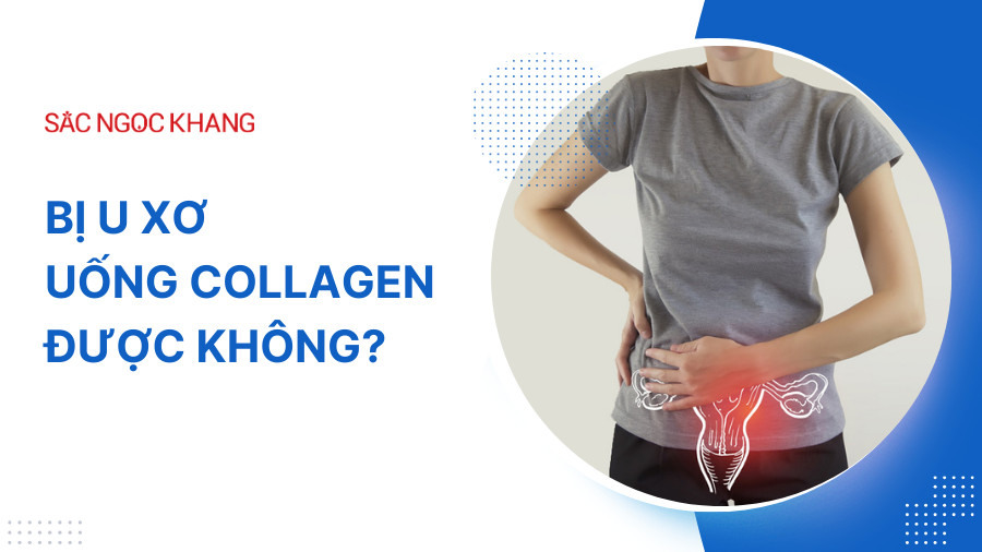 Bị u xơ có uống được Collagen không? Giải đáp chi tiết